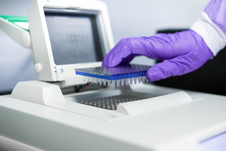 Lyme İgm Positive Nedir?
