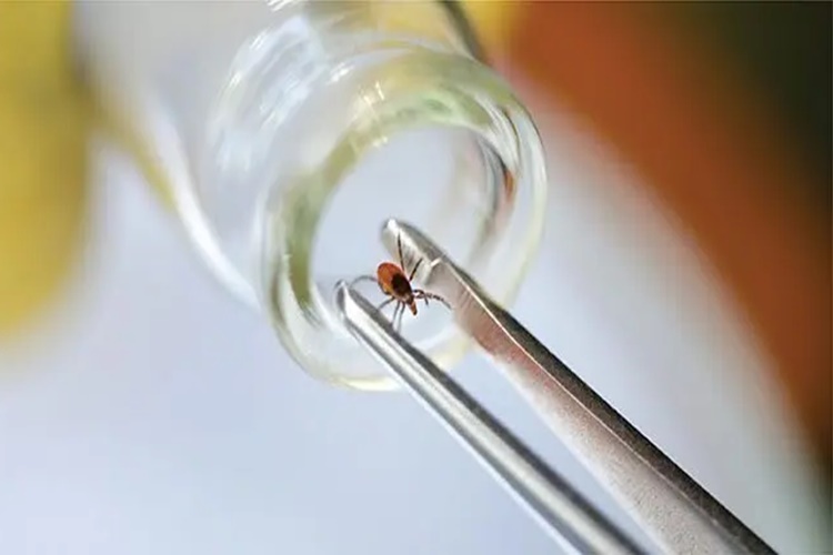 Lyme Testi Nasıl Yapılır?