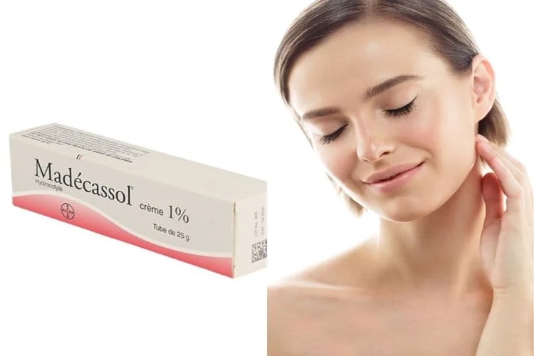 Madecassol Batık Lekelerinde Kullanımı Nasıldır?