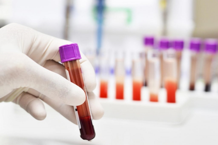 Magnezyum Testi Aç Karnına Mı Yapılır?
