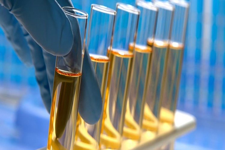  Magnezyum Testi Nasıl Yapılır?