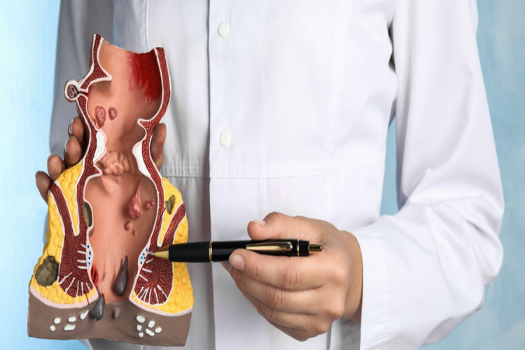 Makat Çatlağı İçin Hangi Doktora Gidilir?