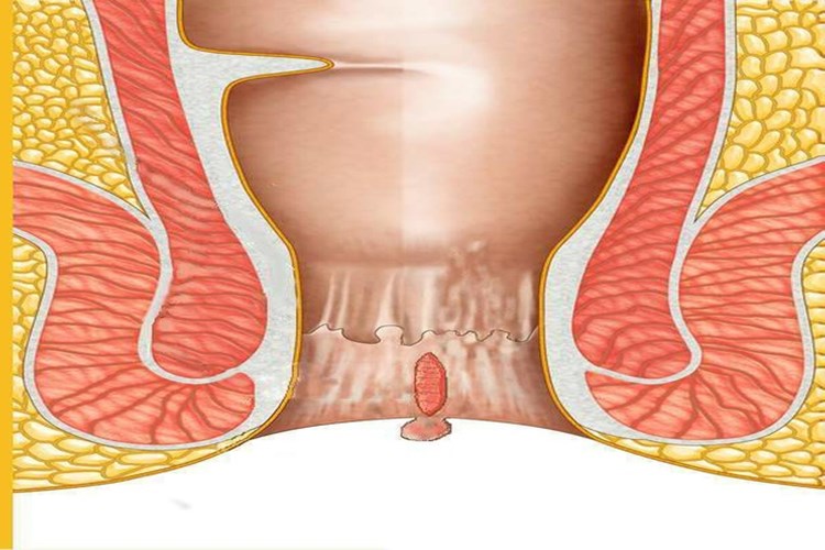 Makat Çatlağı Olduğunu Nasıl Anlarız?