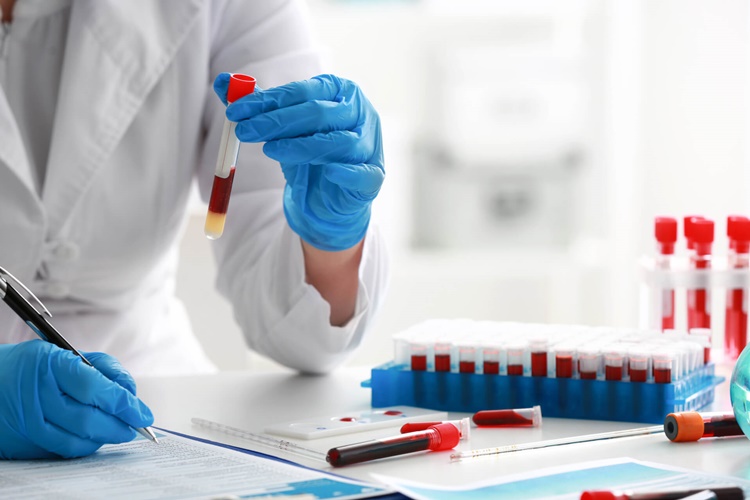 Makroprolaktin Testi Neden Yapılır?