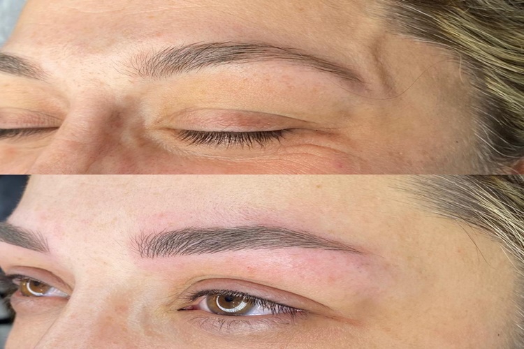 Microblading Kaş Neden Kızarır?