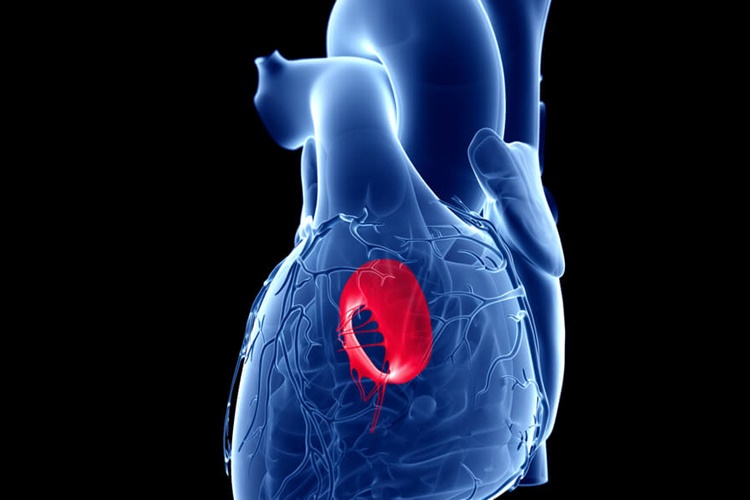Mitral Yetmezlik Hakkında Merak Edilenler