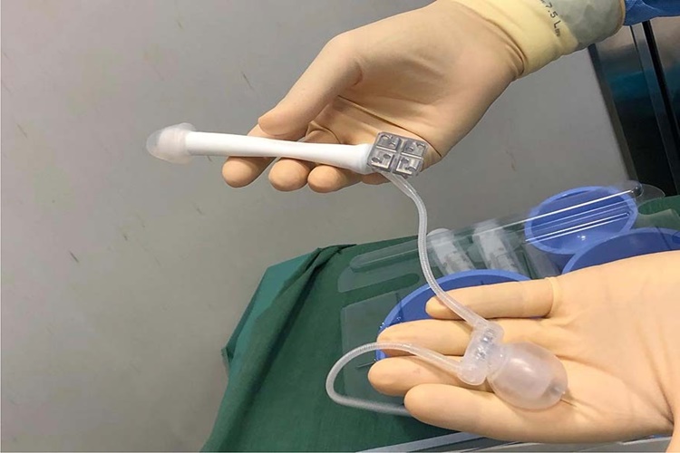 Mutluluk Çubuğu Ameliyatı Nedir?