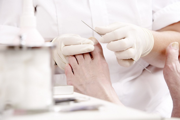 Nasır Ameliyatını Hangi Doktor Yapar?
