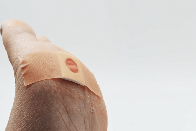 Nasır Bandı İşe Yarıyor Mu?