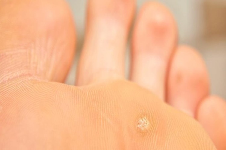 Nasır İçin Okunacak Dua?