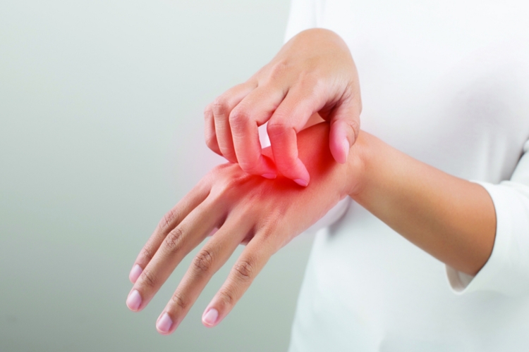 Niacinamide Alerji Yapar Mı?