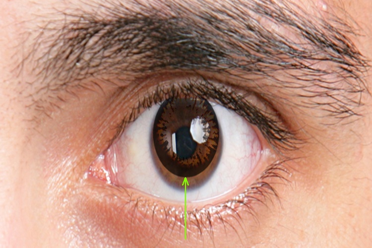 Numaralı Lens Göze Zarar Verir Mi?