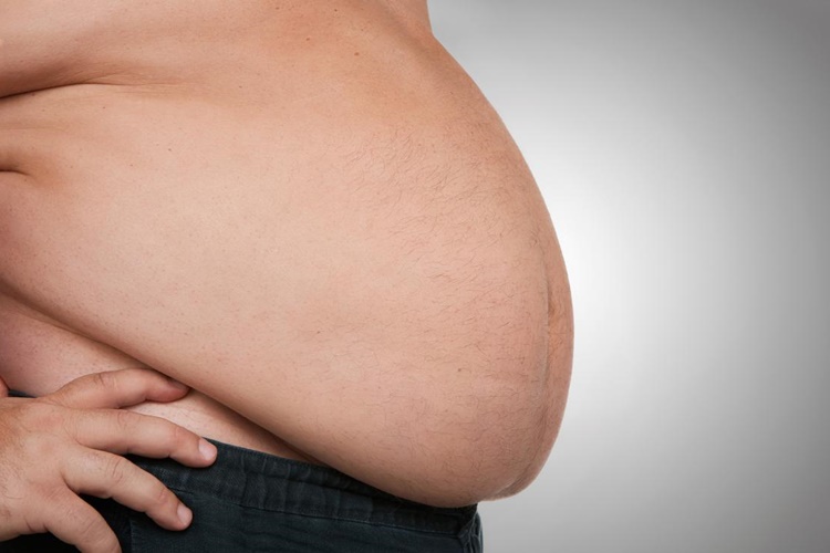 Obezite Hastalığının Tedavisi Var Mı?