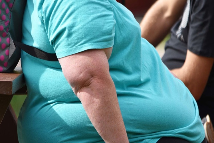 Obezite Kaç Kilodan Başlar?