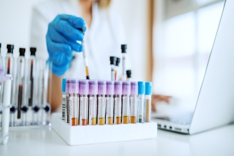 OGTT Testi Neden Yapılır?