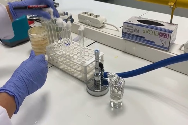 Oksidaz Testi Neden Yapılır?