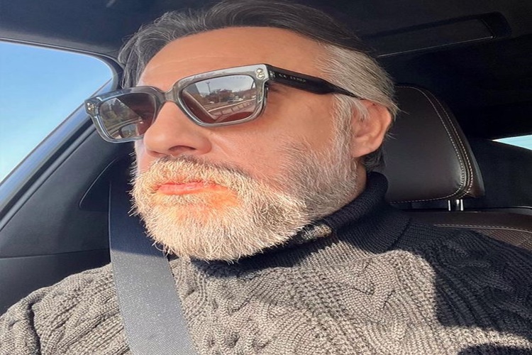 Oktay Kaynarca Saç Mı Ektirdi?