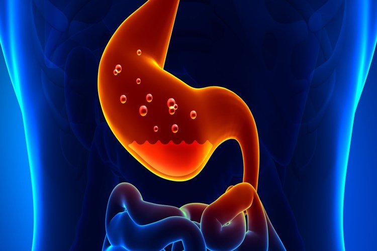 Omega 3 Ülsere İyi Gelir Mi?