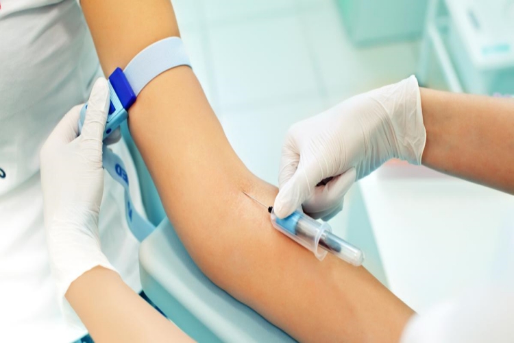 Östrojen Testi İçin Hangi Doktora Gidilir?