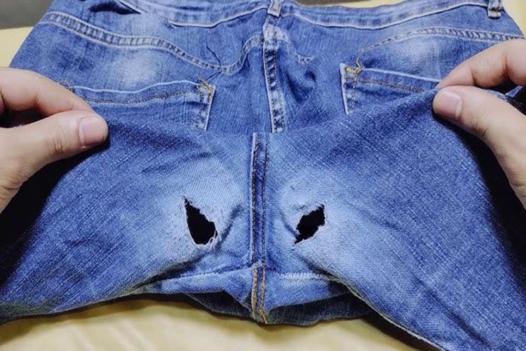 Pantolon Ağı Aşınması Nasıl Önlenir?