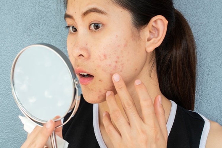 Paraben Kullanımı Yasak Mı?