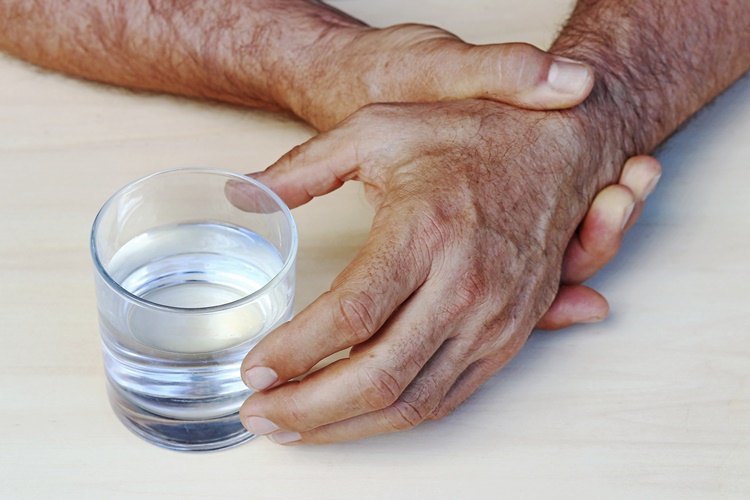 Parkinson Hastalığı Kaç Yılda İlerler?