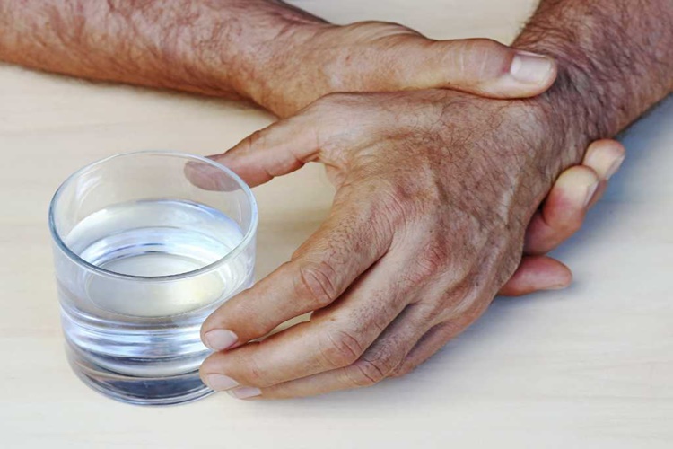 Parkinson Hastası Yüzde Kaç Rapor Alır?