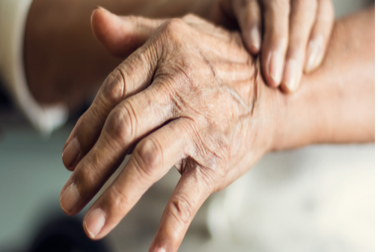 Parkinson Öldürür Mü?