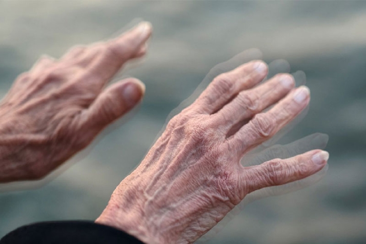 Parkinson Stresten Olur Mu?
