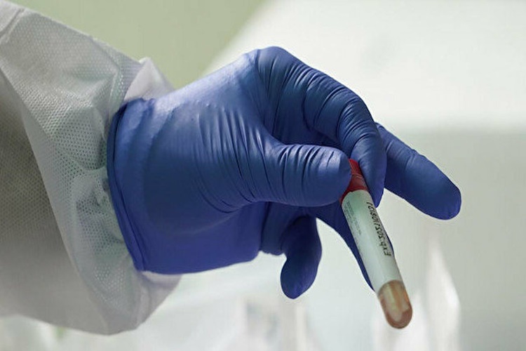 PCR Testi Devlet Hastanesi Ücreti Nedir? 
