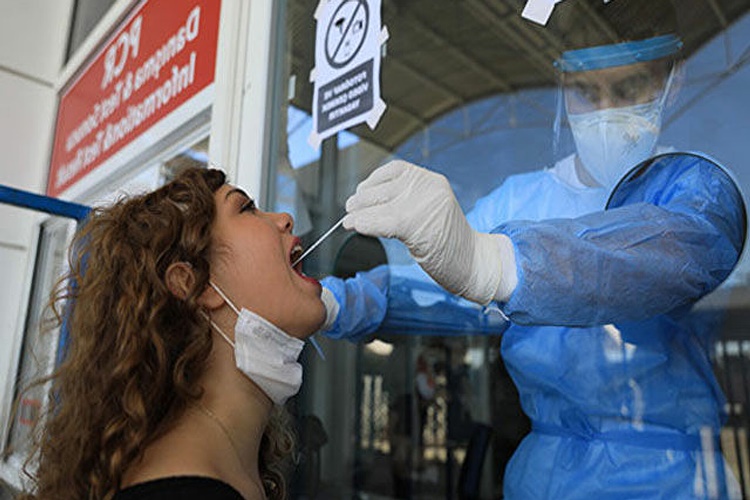PCR Testi Geçerlilik Süresi Nedir?