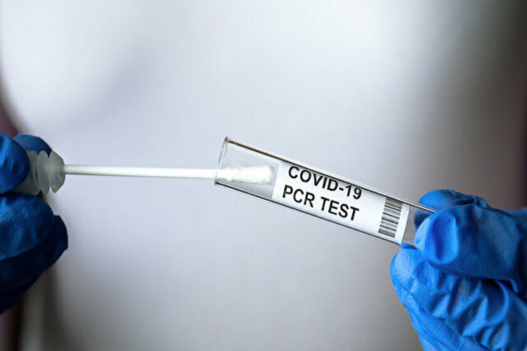 Pcr Testi Zorunlu Olan Ülkeler Hangileridir?