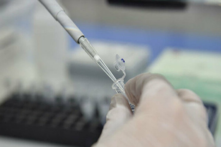 Pcr Testi Zorunluluğu Yasal Mı?