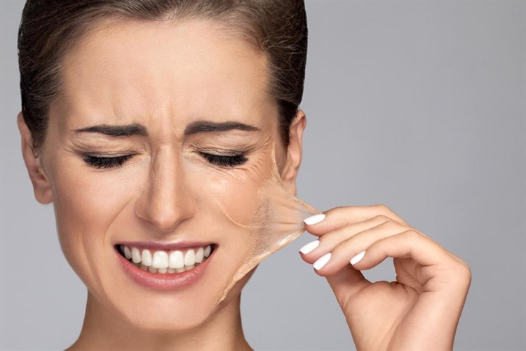 Peeling Her gün Yapılır Mı?