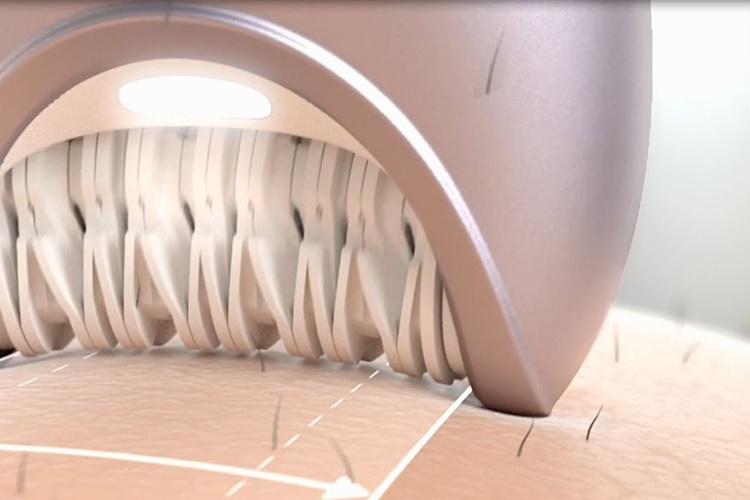 Philips Epilatör Aleti Nasıl Kullanılır?