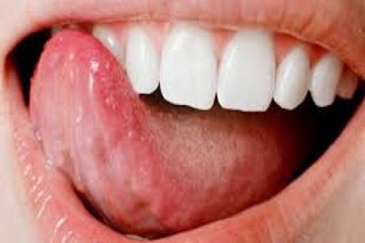 Piraldyne Diş Ağrısına İyi Gelir Mi?