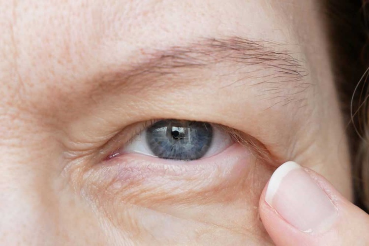 Plaquenil Göze Zarar Verir Mi?