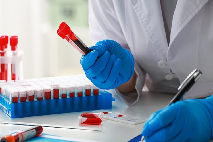 Prolaktin Testi Nasıl Yapılır?