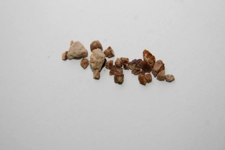 Propolis Böbrek Taşına İyi Gelir Mi?