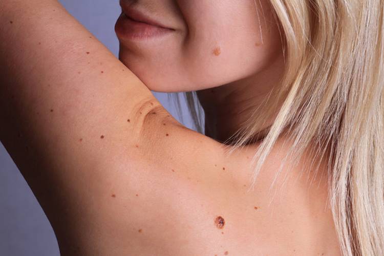 Propolis Et Benine İyi Gelir Mi?