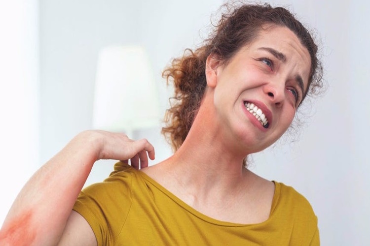 Propolis Kaşıntı Yapar Mı?