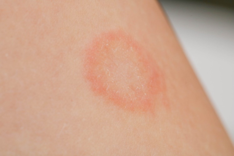 Propolis Mantara İyi Gelir Mi?