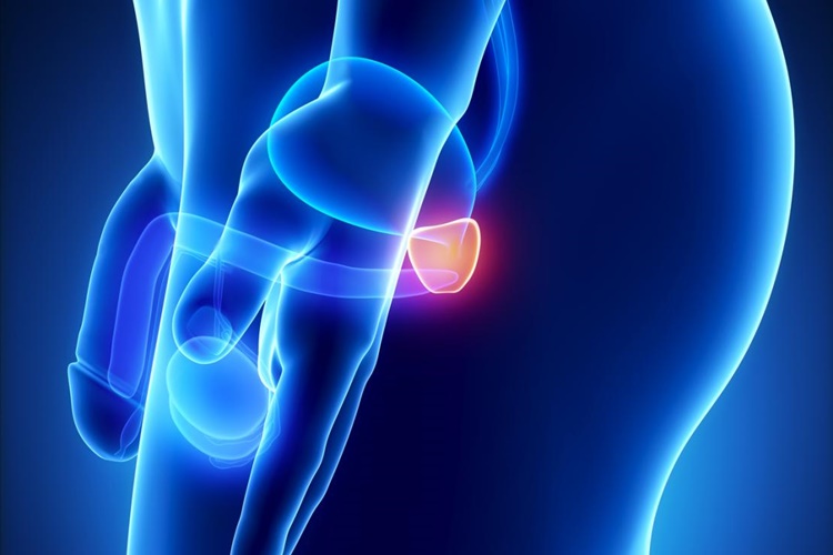 Prostat İltihabı Ultrasonda Görülür Mü?
