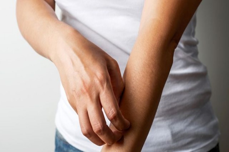 Prozac Kaşıntı Yapar Mı?