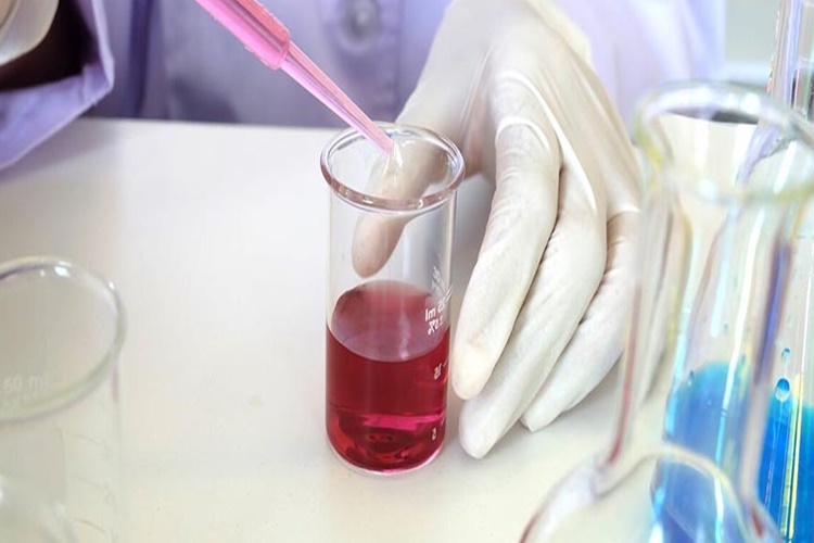 PSA Testi Nasıl Yapılır?