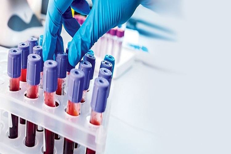 Pseudokolinesteraz Testi Neden Yapılır?