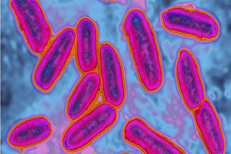 Pseudomonas Aeruginosa Insandan Insana Bulaşır Mı?
