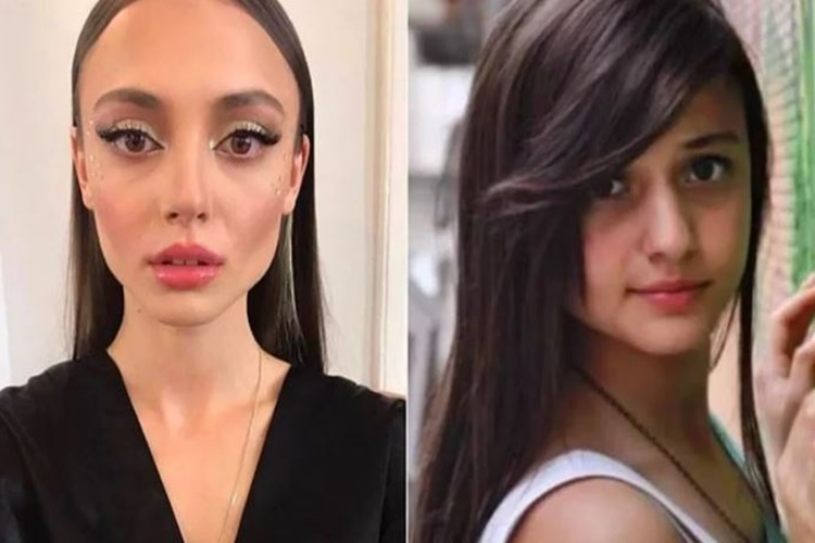 Rabia Soytürk Estetik Yaptırdı Mı?
