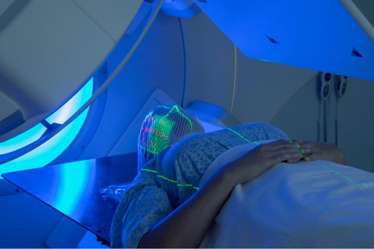 Radyasyon Kanser Tedavisinde Nasıl Kullanılır?