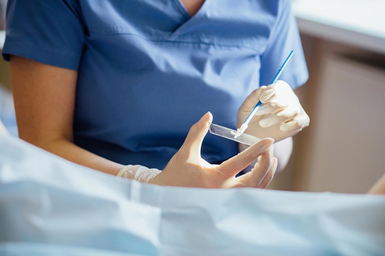 Rahim Alındıktan Sonra Smear Testi Yapılır Mı?